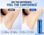 BELORA Mini Electric Shaver – Pocket Size Waterproof Shaver for Men & Women