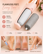BELORA Flawless Pedi Electronic Callus Remover – Rechargeable Foot File for Smooth & Soft Feet