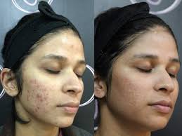 Customer testimonial 3